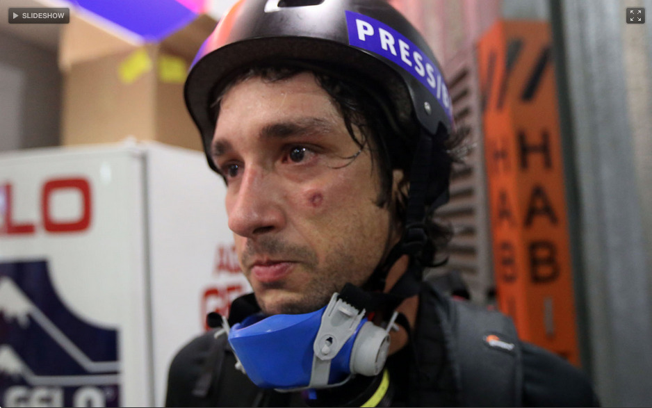 Repórter fotográfico Fábio Braga, da Folha de São Paulo, que foi atingido por um tiro de bala de borracha durante protesto. (foto: JF Diorio/Estadão Conteúdo) (x)