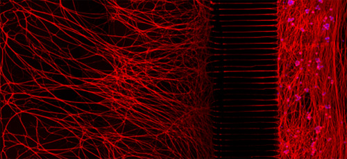 neurosciencestuff:

The Secret Lives (and Deaths) of Neurons
As the human body fine-tunes its neurological wiring, nerve cells often must fix a faulty connection by amputating an axon — the “business end” of the neuron that sends electrical impulses to tissues or other neurons. It is a dance with death, however, because the molecular poison the neuron deploys to sever an axon could, if uncontained, kill the entire cell.
Researchers from the University of North Carolina School of Medicine have uncovered some surprising insights about the process of axon amputation, or “pruning,” in a study published May 21 in the journal Nature Communications. Axon pruning has mystified scientists curious to know how a neuron can unleash a self-destruct mechanism within its axon, but keep it from spreading to the rest of the cell. The researchers’ findings could offer clues about the processes underlying some neurological disorders.
“Aberrant axon pruning is thought to underlie some of the causes for neurodevelopmental disorders, such as schizophrenia and autism,” said Mohanish Deshmukh, PhD, professor of cell biology and physiology at UNC and the study’s senior author. “This study sheds light on some of the mechanisms by which neurons are able to regulate axon pruning.”
Axon pruning is part of normal development and plays a key role in learning and memory. Another important process, apoptosis — the purposeful death of an entire cell — is also crucial because it allows the body to cull broken or incorrectly placed neurons. But both processes have been linked with disease when improperly regulated.
The research team placed mouse neurons in special devices called microfluidic chambers that allowed the researchers to independently manipulate the environments surrounding the axon and cell body to induce axon pruning or apoptosis.
They found that although the nerve cell uses the same poison — a group of molecules known as Caspases — whether it intends to kill the whole cell or just the axon, it deploys the Caspases in a different way depending on the context.
“People had assumed that the mechanism was the same regardless of whether the context was axon pruning or apoptosis, but we found that it’s actually quite distinct,” said Deshmukh. “The neuron essentially uses the same components for both cases, but tweaks them in a very elegant way so the neuron knows whether it needs to undergo apoptosis or axon pruning.”
In apoptosis, the neuron deploys the deadly Caspases using an activator known as Apaf-1. In the case of axon pruning, Apaf-1 was simply not involved, despite the presence of Caspases. “This is really going to take the field by surprise,” said Deshmukh. “There’s very little precedent of Caspases being activated without Apaf-1. We just didn’t know they could be activated through a different mechanism.”
In addition, the team discovered that neurons employ other molecules as safety brakes to keep the “kill” signal contained to the axon alone. “Having this brake keeps that signal from spreading to the rest of the body,” said Deshmukh. “Remarkably, just removing one brake makes the neurons more vulnerable.”
Deshmukh said the findings offer a glimpse into how nerve cells reconfigure themselves during development and beyond. Enhancing our understanding of these basic processes could help illuminate what has gone wrong in the case of some neurological disorders.
