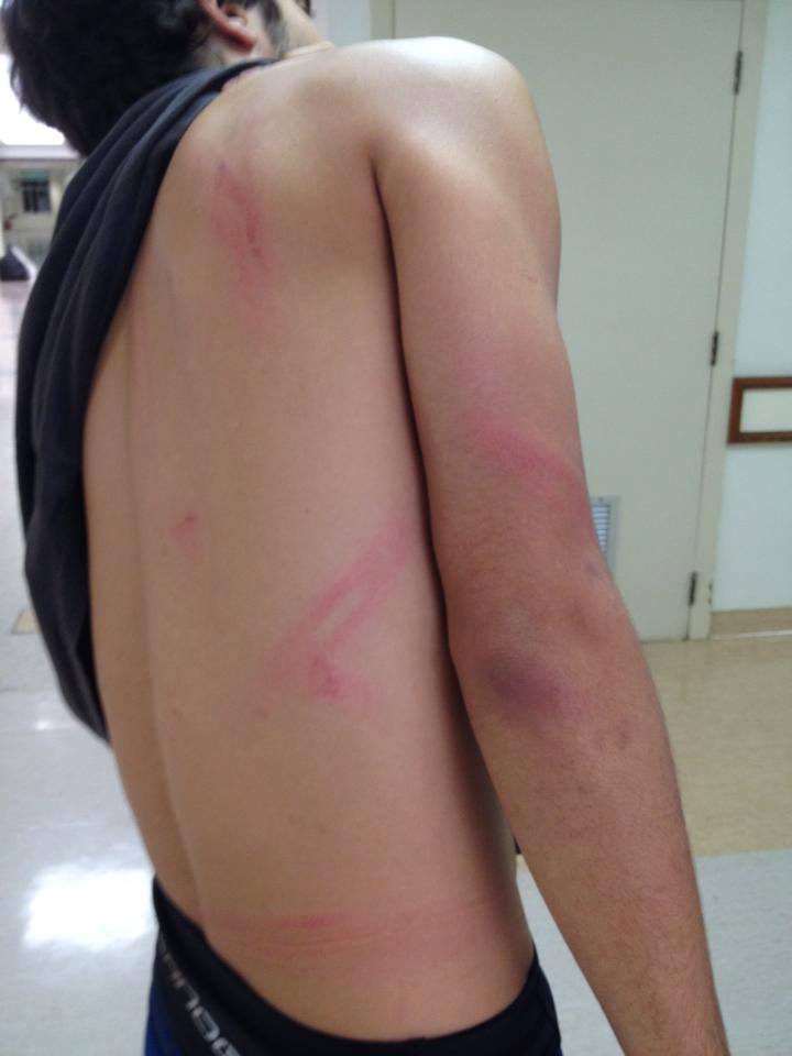 Ciclista que não participava da manifestação é agredido.