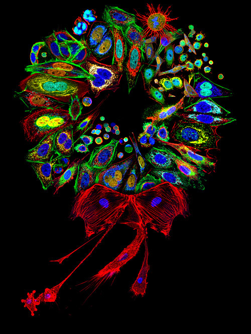 biocanvas:  A variety of mammalian cell types arranged in a wreath formation. Happy holidays from Biocanvas! Image by Dr. Donna Stolz, University of Pittsburgh.  We get TWELVE days of Christmas, so I think this is still ok to post.