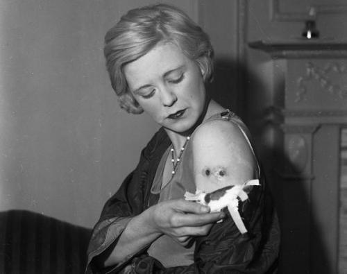 weirdvintage:

Actress Alice Granville shows off two bullet holes in her arm after she was shot by her hitman husband.  The mob moll said that her husband shot her at a nightclub party to “prove his affection,” 1931 (via)
