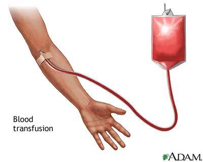 Blood Transfusion Reaction Labs