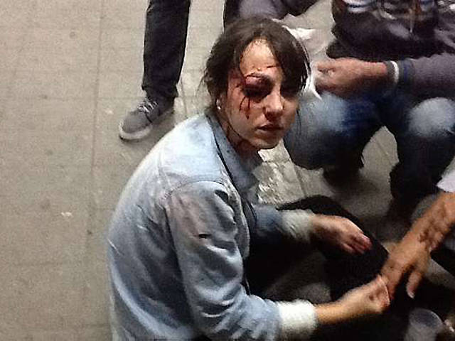 Giuliana Vallone, repórter da Folha, foi atingida por um disparo de bala de borracha da tropa de choque da Polícia Militar (foto: Diego Zanchetta/Estadão Conteúdo) (x)