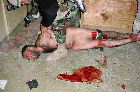 This man was not tortured by the United States, because the United States does not torture.