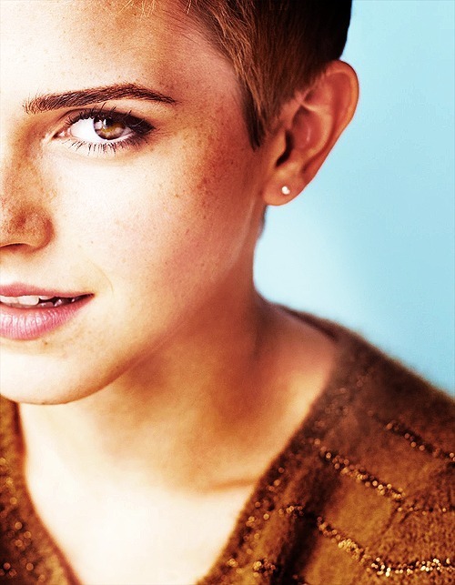 Emma Watson Freckles. favorite #ppl: emma watson