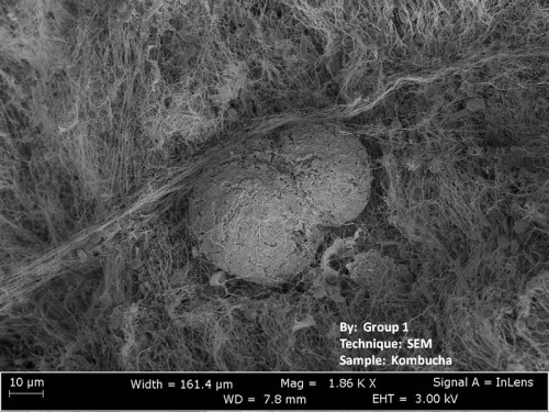 fibres under microscope. under the microscope,