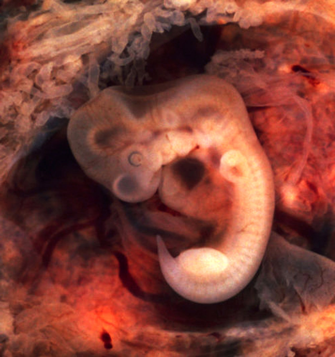 A five week old human embryo