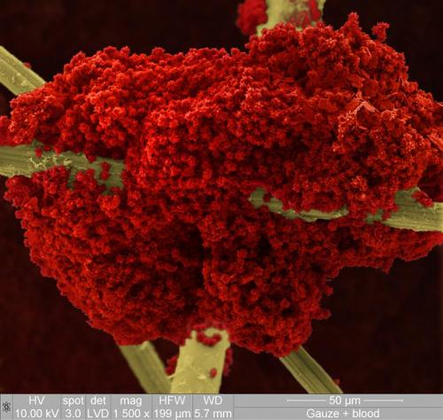 rubthatnub:

Blood Clot on Gauze Dressing Fibres seen through and Electron Microscope
