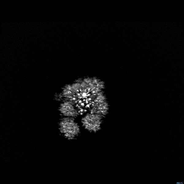 Take a gander at this shit right here, it&#8217;s an MRI of broccoli.
Broccoli contains a fucking ridiculously high amount of potassium, which maintains a boss nervous system and keeps your brain at the top of it&#8217;s game.