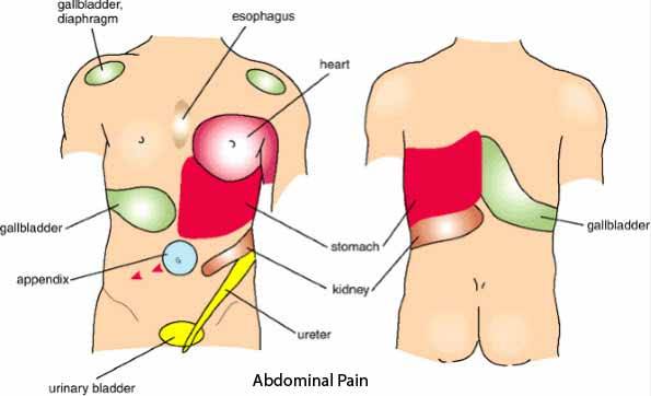 gallbladder pain referral