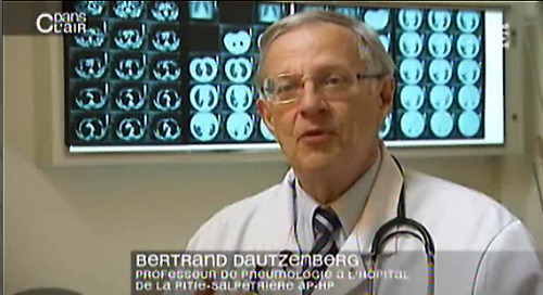 professeur Dautzenberg pneumologue
