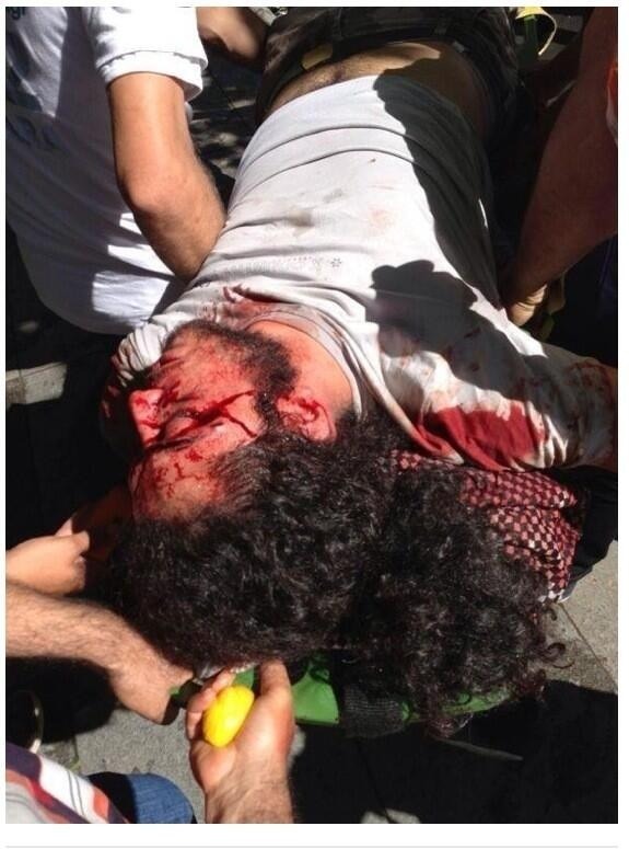 The young man shoot on the head in Ankara