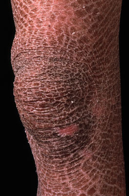 skin rash on legs #9