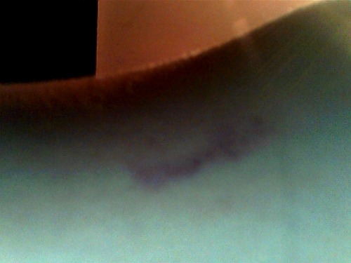 /coughs. gave myself a hickey on my arms.