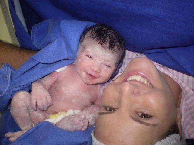 Baby born with 8 limbs in india