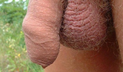Scrotum Images - Photos - Pictures - CrystalGraphics