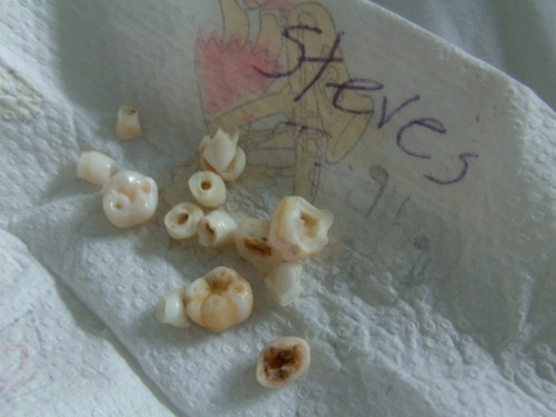 komakill: mum kept all my baby teeth in a piece of the simpsons kitchen roll 