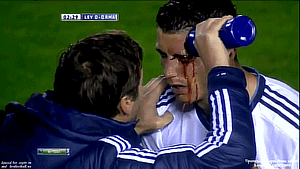 صور اصابة كريستيانو رونالدو في العين - بالصور اصابة رونالدو في مباراة ليفانتي و ريال مدريد