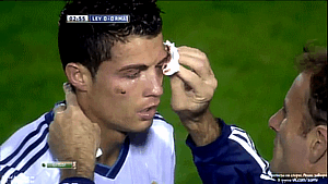 صور اصابة كريستيانو رونالدو في العين - بالصور اصابة رونالدو في مباراة ليفانتي و ريال مدريد